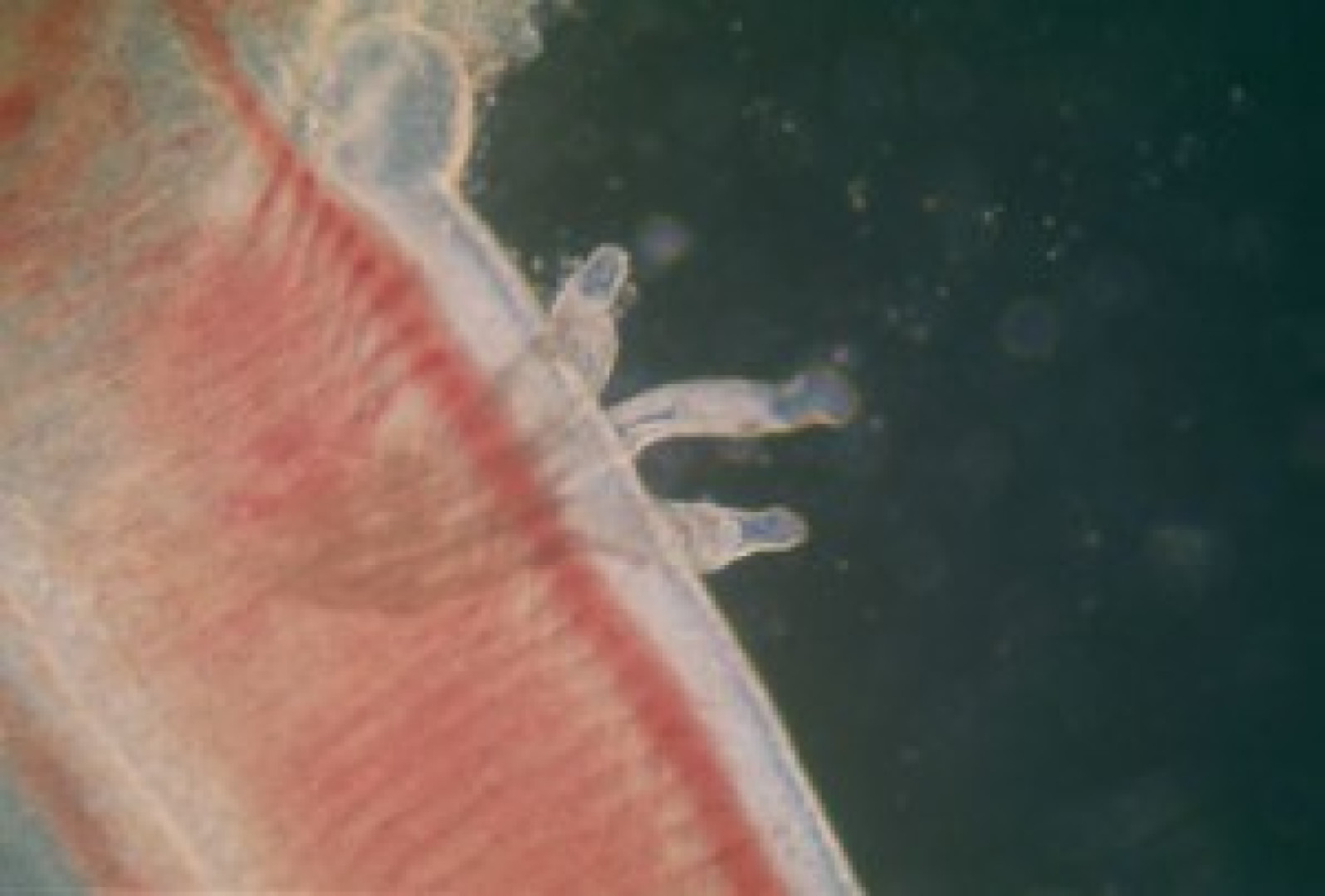 Dactylogyróza a gyrodaktylóza - žiabrohlisty